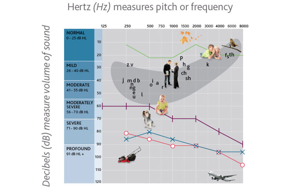 Misura decibel per intervento riabilitativo del bambino sordo
